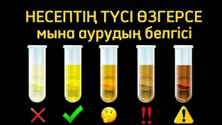 НЕСЕП түсінің ӨЗГЕРУ СЕБЕБІ. Зәрдің түсі неге өзгереді. Денсаулық арнасы. Денсаулық