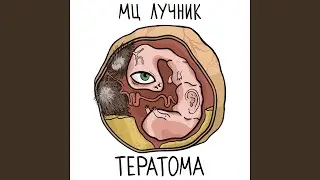 Тератома