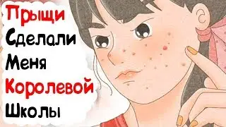 Прыщи Сделали Меня Королевой Школы (История из Жизни)