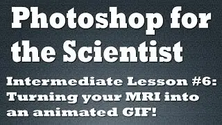 Turning your MRI into an animated GIF