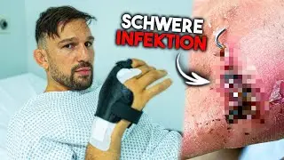 My hand is screwed... I need another emergency operation