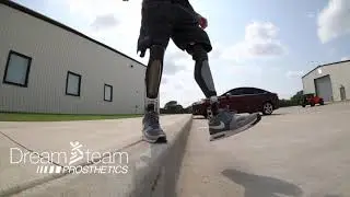 Bilateral Above Knee Amputee Using C-Leg 4 Knees