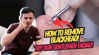 Gentlemen facial | Influencer Fateh di RJ Clinic