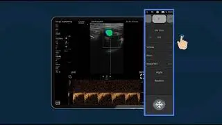 7   Cómo usar el modo Doppler Pulsado