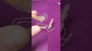 Аппарат Бимлера для работы с прикусом. Узнать больше vedental.ru