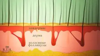 6. Процедура для питания корней волос 