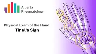 Rheumatology HAND exam: Tinel's Sign for Carpal Tunnel Syndrome