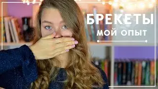 БРЕКЕТЫ // МОЯ ИСТОРИЯ