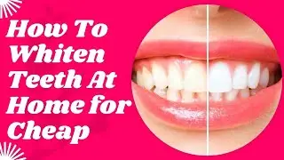 100% Effective Natural Ways to Whiten Teeth at Home | White Teeth in 2 Minutes |Natural Cures System