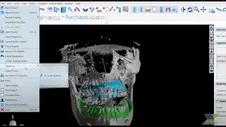 BSP V13: BlueSkyPlan to X-Guide Bridge:  Elevate Your Surgical Workflow