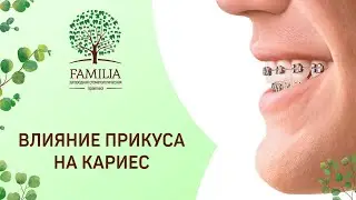 Влияние прикуса на развитие кариеса | Стоматология Краснодара