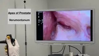 Core Videos (2025): Flexible Cystoscopy: Procedural Techniques and Teaching Applications