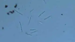 Bacillus (бациллы) под микроскопом