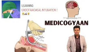 What is Endotracheal Intubation?