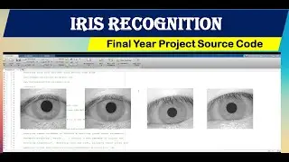 Iris Recognition Using Matlab Project | Iris Recognition Using Machine Learning Matlab Project Code
