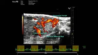 Mid-gestational Mouse Placenta