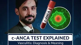 c-ANCA Test | MLT Hub with kamran