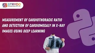 Measurement of Cardiothoracic Ratio and Detection of Cardiomegaly in XRay Images Using Deep Learning
