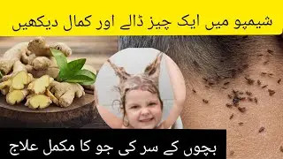 Say "Bye Bye" Forever to Head Lice #lice #treatment