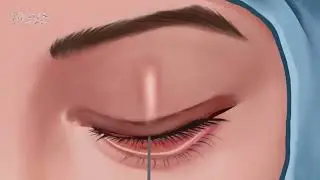 ASMR Dirt and stone removal in deep belly button| Remove Huge Navel Stone Animation