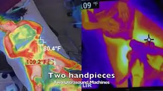 US and RF hips and inner thighs S