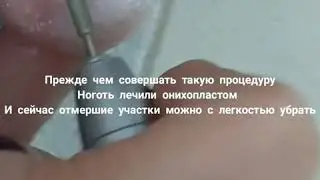 Протезирование ногтей. Наращивание полигелем на педикюре. Polygel City nail.