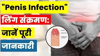 पेनिस इंफेक्शन (Balanoposthitis): लक्षण, कारण और उपचार | Dr.  Neel Patel