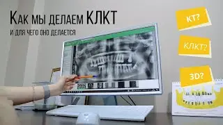 Как мы делаем КТ и для чего оно нужно?