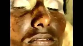 Öncesi ve Sonrası