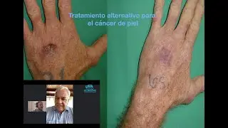 Terapia fotodinámica