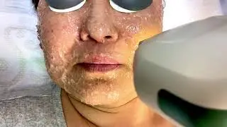 Facial Rejuvenation Treatment