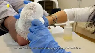 What to do when antibiotic treatment is unsuccesful?