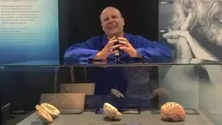 What is a concussion and what happens to our brain when we experience trauma?