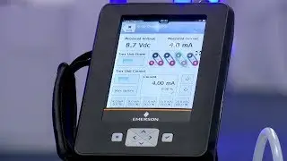 How to Use AMS Trex Loop Diagnostics to Troubleshoot Issues