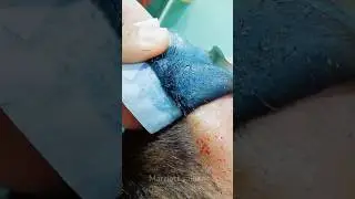 Facewax 