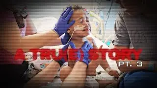 You Wont Believe What The Doctor Wants To Remove❗️Is Surgery The Only Option❓