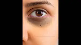 Remove Eye Bag in Photoshop