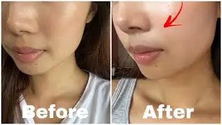 ZIIP HALO FACIAL TONING DEVICE REVIEW | Before & After Pics! BEST Anti-aging At Home Device