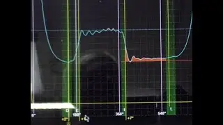 И опять про этот Фиат Альбея!
