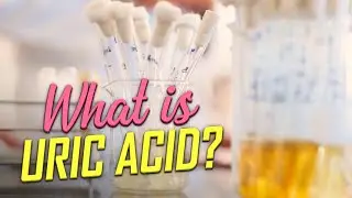 What is uric acid?  [natural healthcare] how to reduce high uric acid
