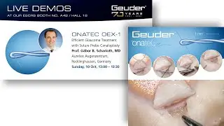 Canaloplasty presentation by Prof. G. Scharioth: Re-establish natural outflow in open-angle glaucoma