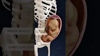 Why is recognizing a footling breech position crucial for a safer delivery? Obstetrics in 3D