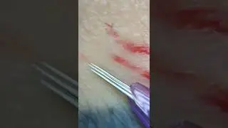 ТАТУИРОВКА ПОД МИКРОСКОПОМ