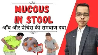 Mucous in Stool | आंव की रामबाण होम्योपैथिक दवा | Dr. Shivam Upadhyay