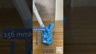 Wound Packing with STAT