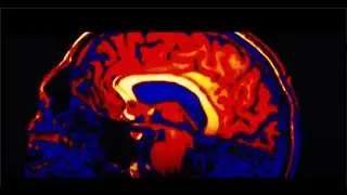 Sub-Specialty – Epilepsy | Department of Neurological Surgery | UCI School of Medicine