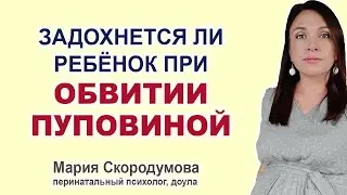 Опасно ли обвитие пуповиной вокруг шеи ребенка во время беременности?
