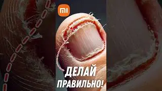 Как СТРИЧЬ НОГТИ БЕЗОПАСНО с XIAOMI 