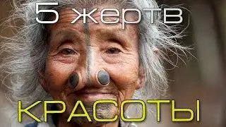 Топ 5 самых жутких жертв красоты