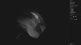 3D MRI Renderer (Rust/WASM)